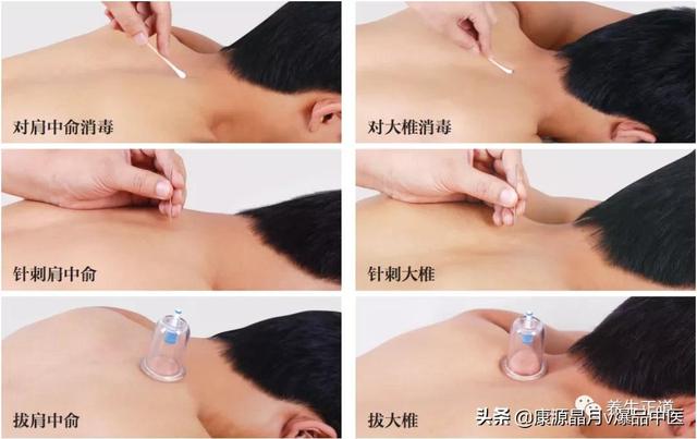 轻松治疗颈椎病的穴位，自我按摩7个穴位让颈椎更轻松