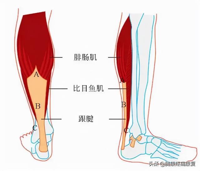肥胖小腿疼(肥胖小腿疼怎么回事)