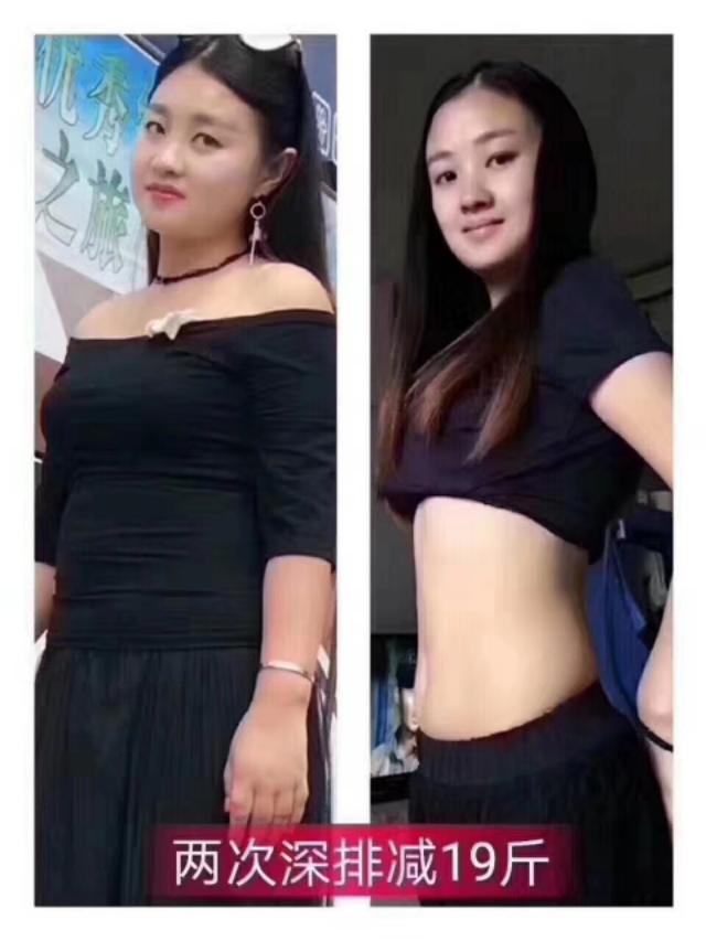 肥胖腿很硬(胖子腿上的肉特别硬怎么减肥)
