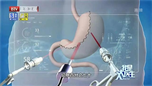 减肥期间可以吃多少g鸡爪，这些食物堪称\
