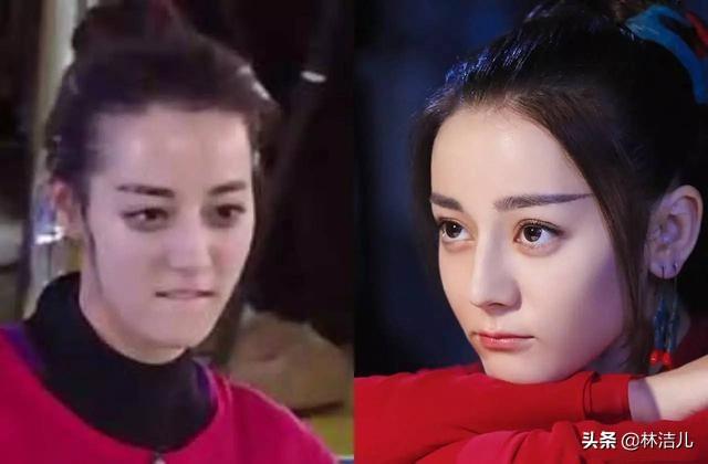 杨幂植发知乎，有种“整容”叫杨幂植发