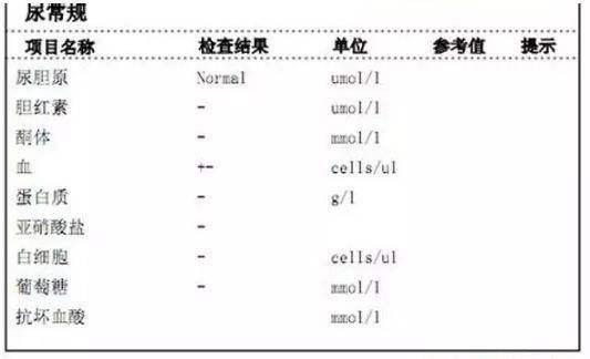 尿常规怎么检查，男性尿常规怎么看（5分钟判断身体健康）