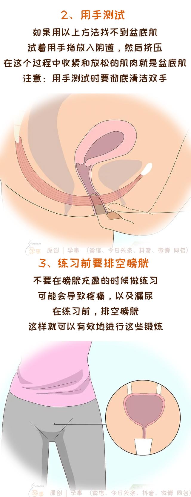 凯格尔运动方法，凯格尔运动，你做对了吗
