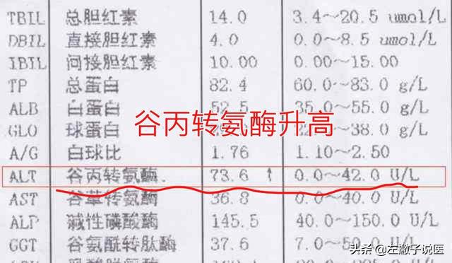谷丙转氨酶高怎么办，谷丙转氨酶偏高的原因和解决办法（转氨酶升高，是肝病的信号吗）
