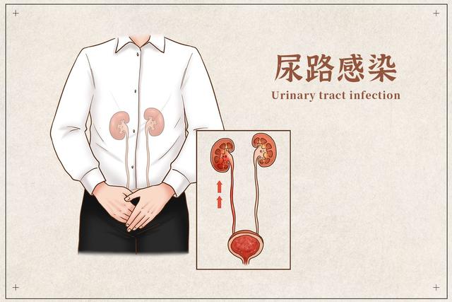 糖尿病并发泌尿系感染(糖尿病并发泌尿系感染的表现)