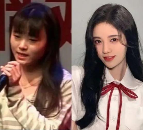 换脸成功的人，顶着“面具脸”41年苦不堪言