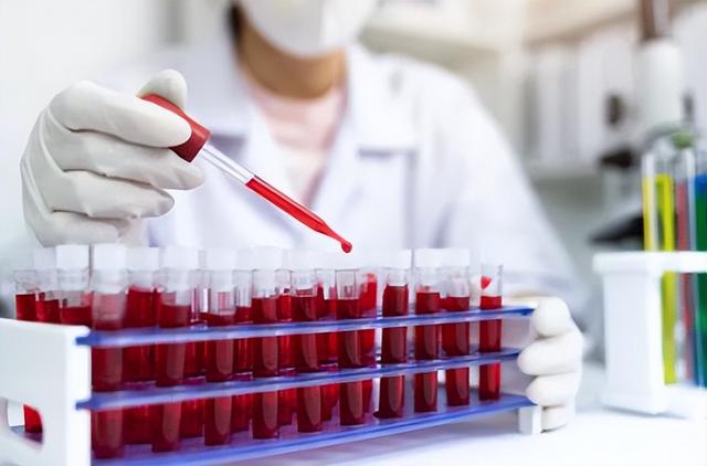 什么是黄金血型，黄金血型到底有多罕见