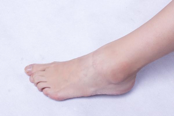 反复踮脚有什么好处，大妈坚持踮脚七八年