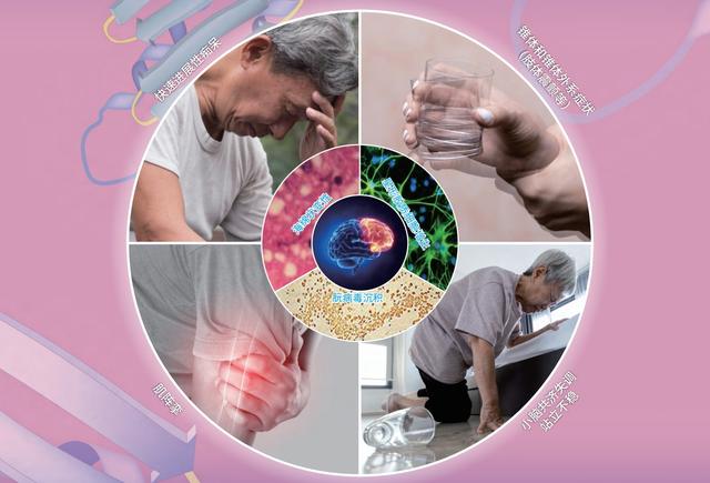 致死率达100烹煮都杀不死的朊病毒，朊病毒到底是什么病毒