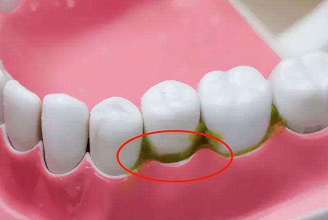 漱口水的作用与危害，建议长期使用漱口水吗（漱口水竟然也有危害）