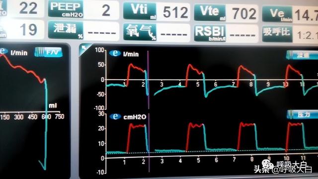 5个呼吸机常见参数设置，呼吸机各种模式需要调的参数（送给临床小白——呼吸机模式及参数设置图文详解）