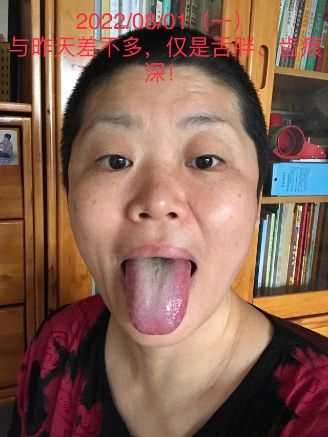 舌象知病图解23张高清大图（舌象诊病高清图片）