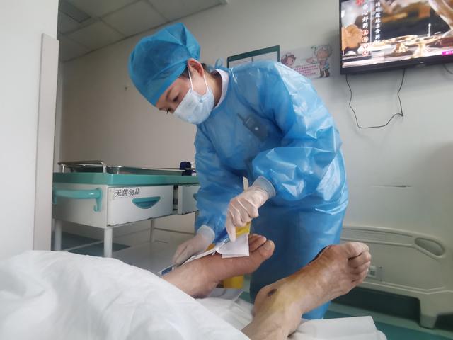 糖尿病腿部按摩仪(糖尿病腿部按摩有用吗)