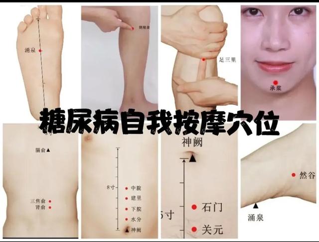 穴位压力刺激贴糖尿病(压力刺激贴的作用与功效)