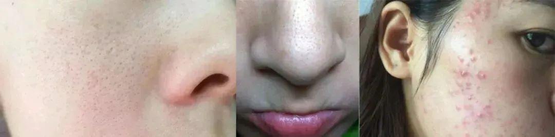 海蓝之谜洗面奶，lamer海蓝之谜洗面奶（公认好用的5款洗面奶）