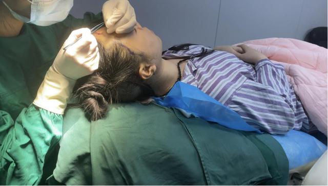 一图解析植发手术全流程，揭秘植发手术的全过程