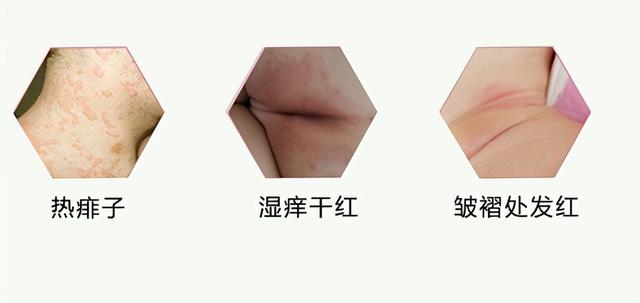 泰国青草膏的功效和作用，泰国卡瓦库德青草薄荷膏