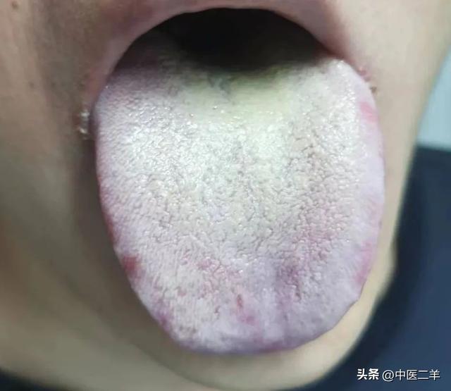 奔豚肥胖(奔豚汤配方)