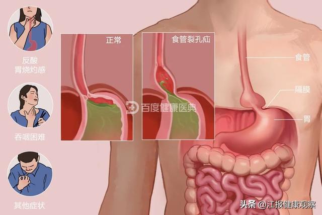德安肥胖爱心捐款(德安肥胖爱心捐款事件)