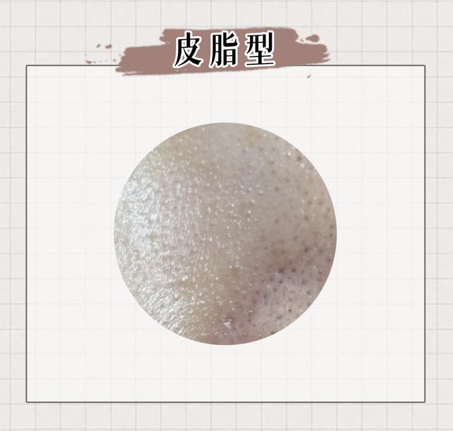 缩毛孔最有效方法，收缩毛孔最好的方法