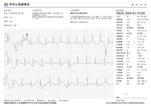 华为watch智能手表功能详解，Buds：打破常规