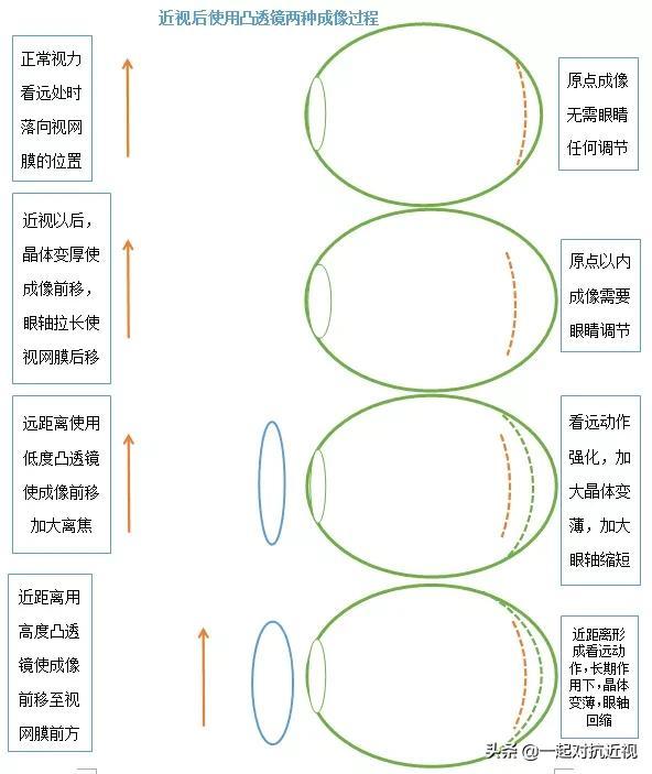 眼睛的成像原理示意图，眼睛所有成像过程一览