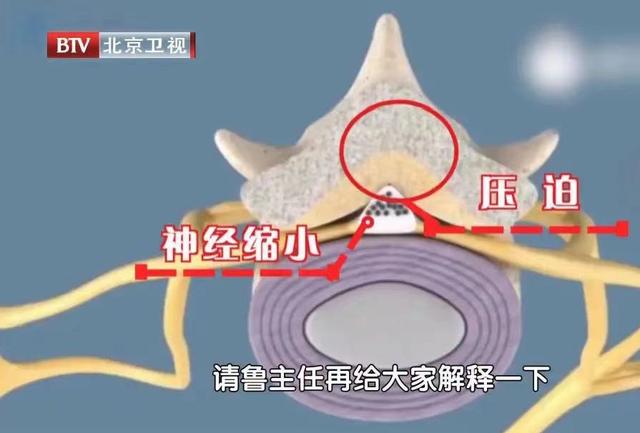 脚上最常见的症状，双脚发生7个异常变化