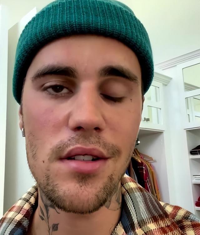 五位名人身体发生意外，世界上仅剩10位铁肺人