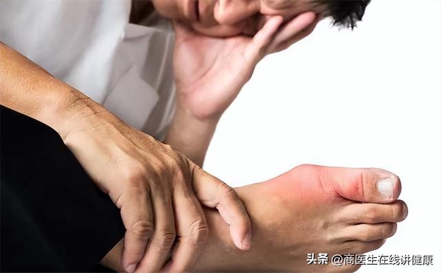糖尿病手心干(糖尿病手心干燥)