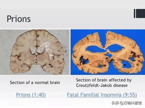 朊病毒到底是一种什么东西，千万别吃同类的肉