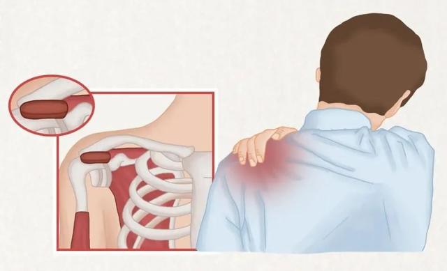 肩颈酸痛的厉害是什么原因，五大原因六大方法来缓解