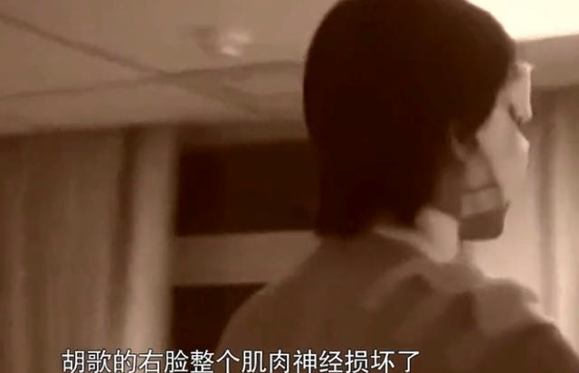 胡歌车祸后复出的样子，胡歌车祸毁容女助理离世