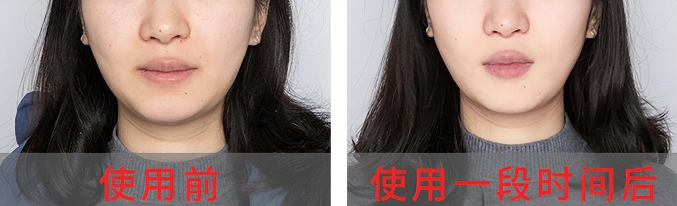 雅詩蘭黛紅石榴系列適合年齡,雅詩蘭黛紅石榴系列適合皮膚 雅詩蘭黛紅石榴系列適合年齡,雅詩蘭黛紅石榴系列適合皮膚