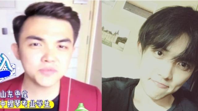 换脸成功的人，顶着“面具脸”41年苦不堪言