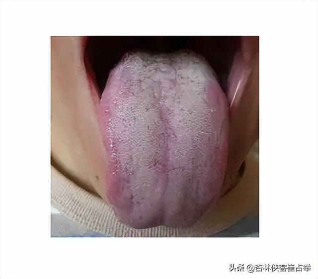 肥胖大便很细(肥胖会导致大便变细吗)
