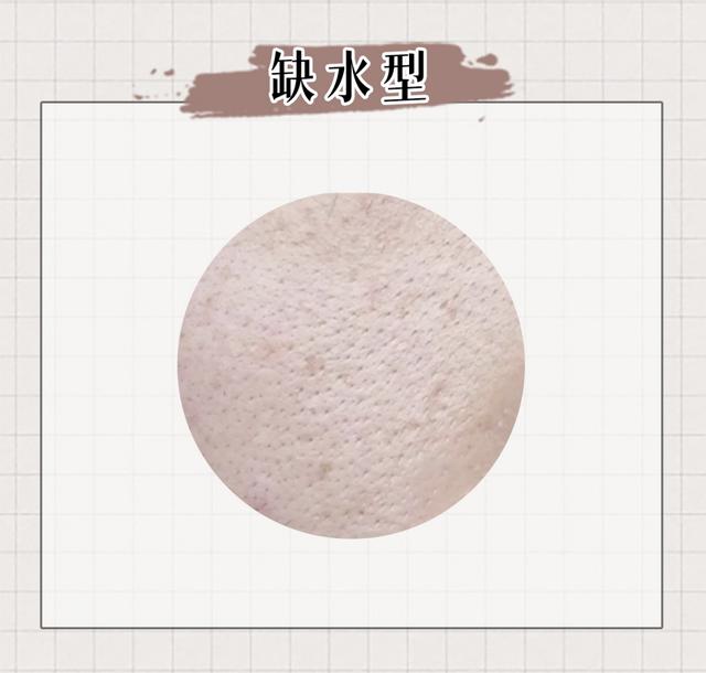 缩毛孔最有效方法，收缩毛孔最好的方法