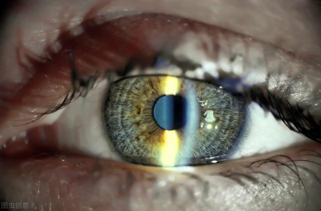 眼睑的位置图片，从上眼睑可以看出身体病症吗