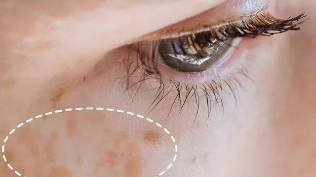 遮瑕的正确方法，新手必看遮瑕攻略