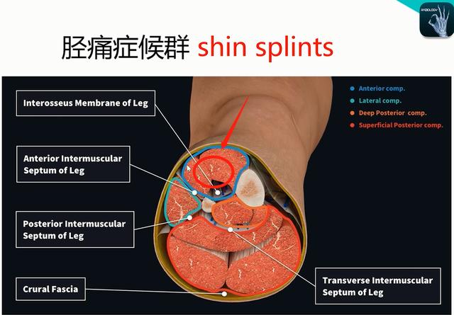 髋关节疼痛与膝盖的关系，膝盖疼当是“风湿关节炎”
