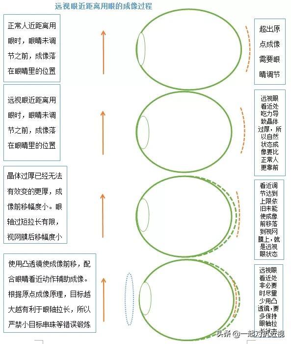 眼睛的成像原理示意图，眼睛所有成像过程一览