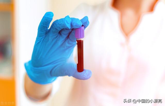 蓝血人到底是什么，世界上真的有蓝血人