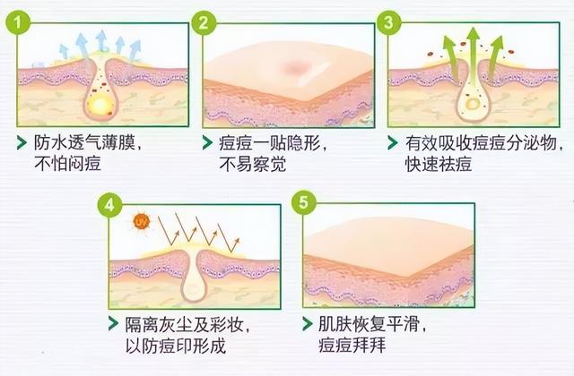痘痘贴对什么有用，其实遮瑕好过祛痘