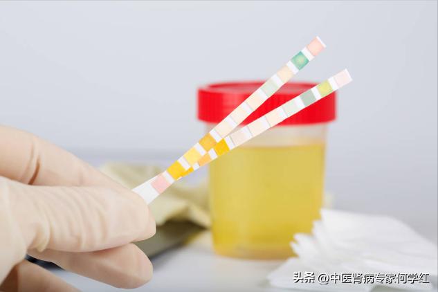 糖尿病尿3(糖尿病尿3十是什么回事)