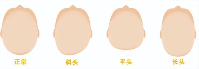 婴儿的囟门是怎么样的，宝宝的囟门妈妈你了解吗