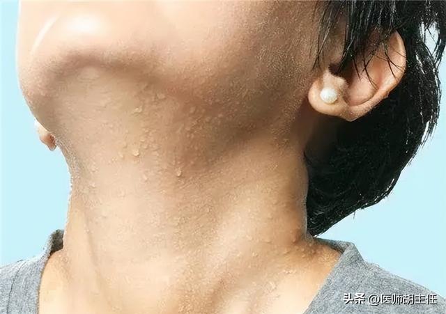 人为什么会出汗，为什么人非常能出汗是什么原因（人为什么会出汗）