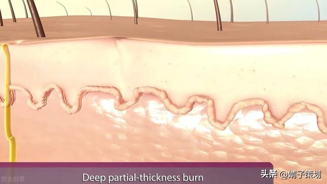 皮肤组织结构图，皮肤组织示意图讲解