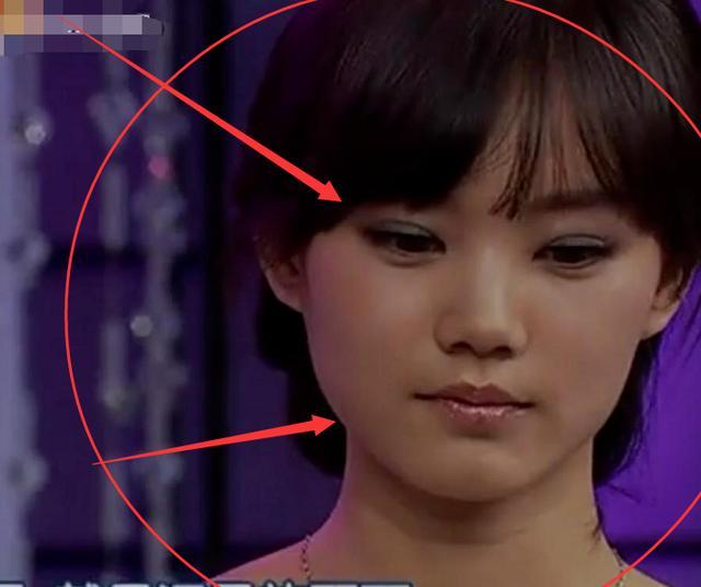 整容失败的明星，整容失败最严重的明星