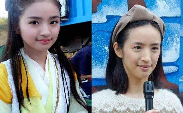 娃娃脸和瓜子脸的区别，为什么有的娃娃脸老了还显年轻