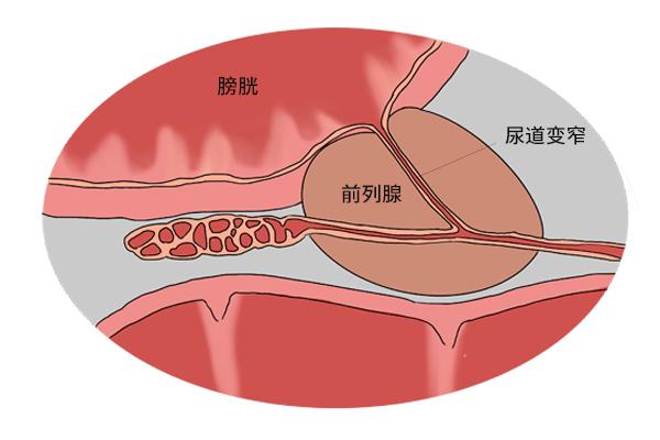 八大癌症防癌筛查怎么做，八大癌症筛查怎么做