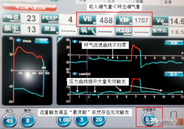 5个呼吸机常见参数设置，呼吸机各种模式需要调的参数（送给临床小白——呼吸机模式及参数设置图文详解）